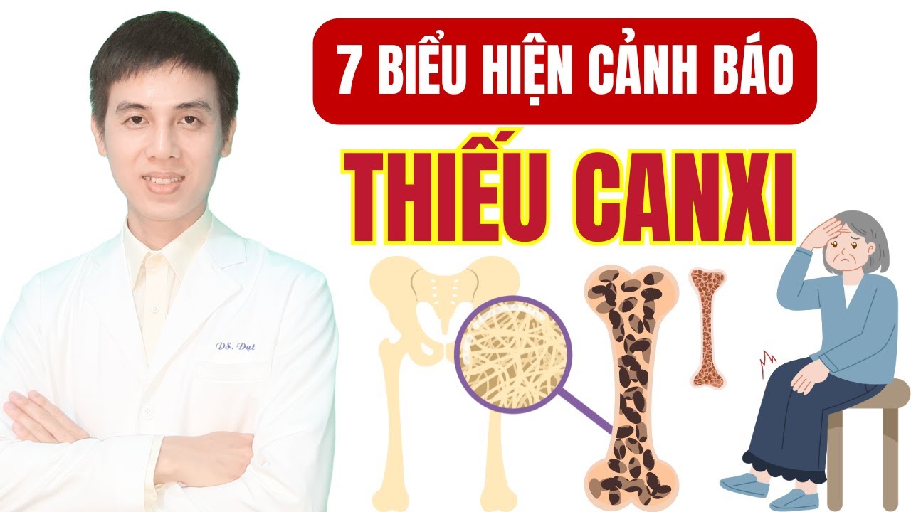 Thiếu canxi ở người lớn có 7 triệu chứng