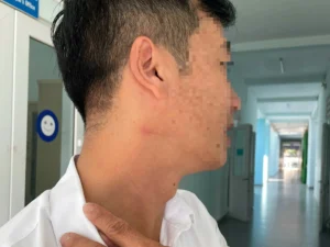Vụ thầy giáo hành hung đồng nghiệp